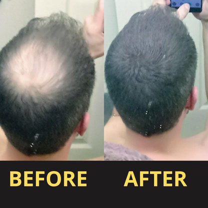 AURAQS™ Hair Concealer 50ML - Waterproof 3–7 days.