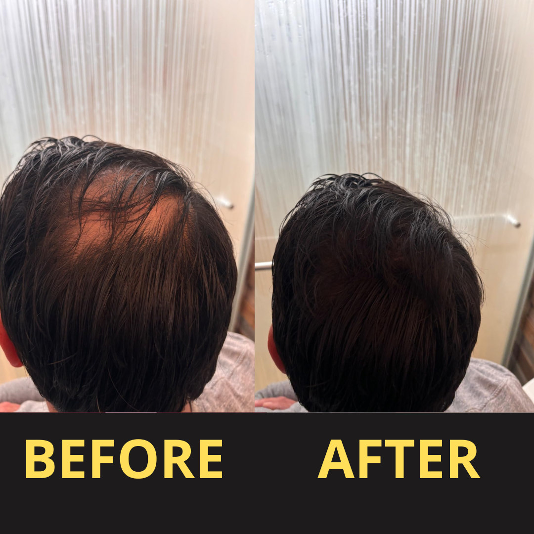 AURAQS™ Hair Concealer 50ML - Waterproof 3–7 days.