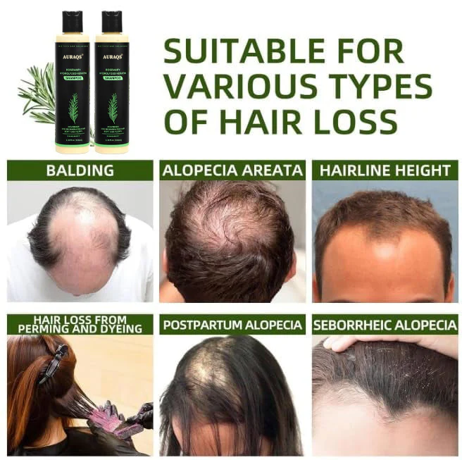 🔥LAST DAY 80% OFF - 🎅AURAQS® Organic Rosemary Hair Growth Shampoo