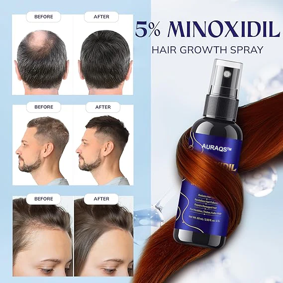 AURAQS™ Hair Growth Serum: Ultra-potent Minoxidil anti-hair loss treatment serum