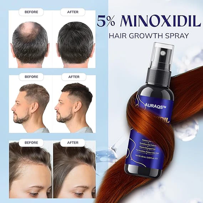 AURAQS™ Hair Growth Serum: Ultra-potent Minoxidil anti-hair loss treatment serum